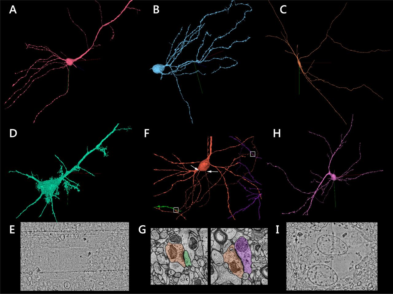 (A) Нейрон пирамидальной формы, почти лишённый шипов. (B) Нейрон с морфологией интернейронов, но с множеством шиповидных выступов на дендритах. (C) Редкий интернейрон, проходящий горизонтально (по касательной) через набор данных. (D) и (E) Пример «тёмной» клетки в ткани, имеющей морфологию пирамидных клеток. (F) Нейрон с двумя отдельными аксонами, выходящих из сомы (белые стрелки). Оба образуют исходящие синапсы (в прямоугольниках), показанных в (G). (H) Нейрон с необычным дендритным деревом (тело клетки смещено в сторону). (I) Поперечное сечение тела клетки астроцита с двумя ядрами. 