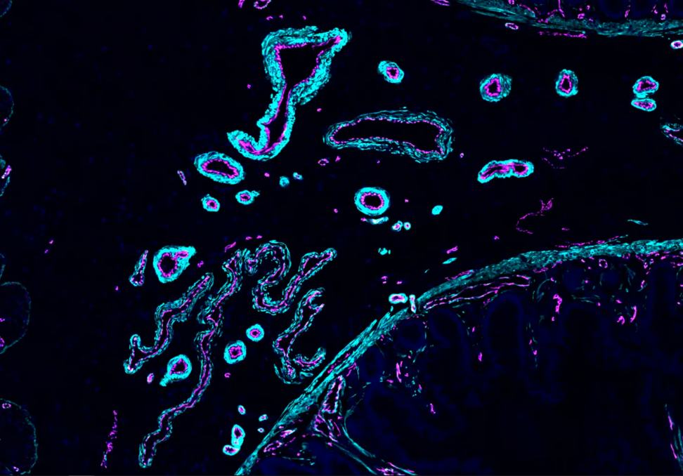 Кровеносные сосуды в образце подвздошной кишки человека. Иммунофлуоресцентное окрашивание выделяет эндотелиальные клетки пурпурным цветом, маркированные CDH5, и гладкомышечные клетки голубым цветом, маркированные ACTA2. Ана-Мария Куйба