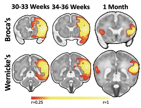 Развитие мужполушарных связей центра Брока и области Вернике в третьем триместре и в первый месяц жизни. Научная статья «Functional connectivity for the language network in the developing brain: 30 weeks of gestation to 30 months of age» [doi:10.1093/cercor/bhab415]