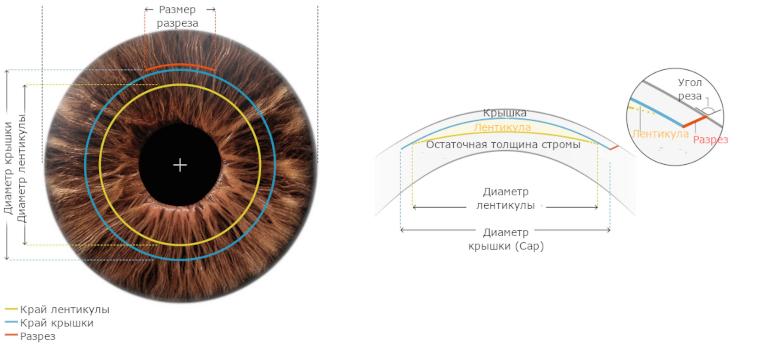 C:UsersПользовательDesktopxsmartsight-tecnologiya-small.jpg.pagespeed.ic.Dqb6sTNB55.jpeg