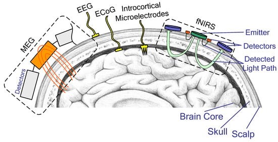 В тени Neuralink. Техномедицинские аспекты нейрокомпьютерных интерфейсов - 5