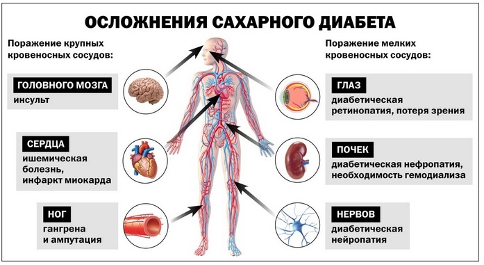 Регуляция сахара в крови - 2