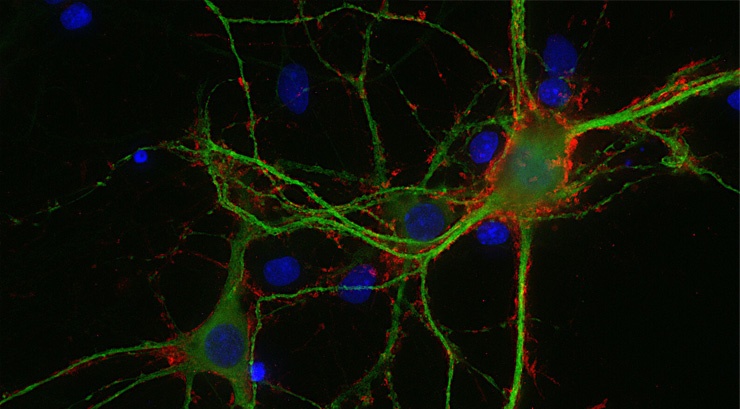 Иммунохимическое окрашивание нейронов в культуре. Красный цвет – окрашивание антителами к синаптобревину – белку синаптических везикул. Зеленый – окрашивание на белок микротрубочек MAP2. Синий – DAPI, стандартный краситель для клеточных ядер.